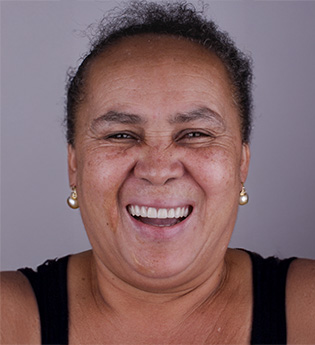 Depois - Clínica Estética e Sorriso